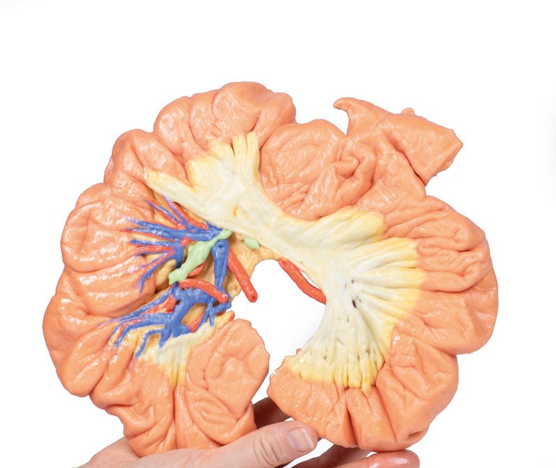 Tarm - Del af Ileum - eAnatomi