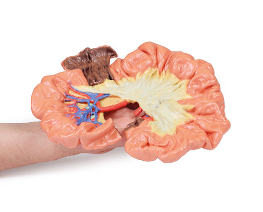 Tarm - Del af Ileum