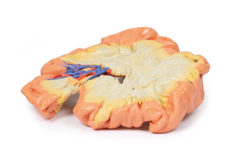 Jejunum - eAnatomi
