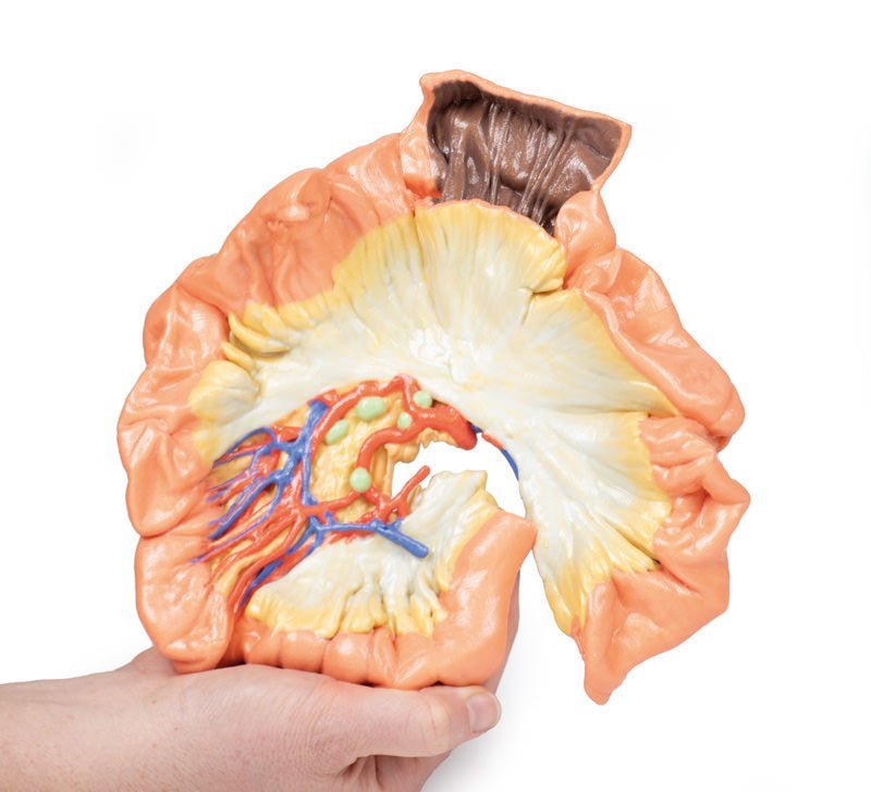 Jejunum - eAnatomi
