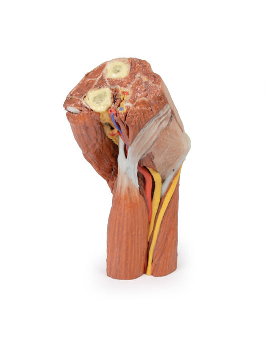 Cubital fossa - muskler, store nerver og brachialis arterie