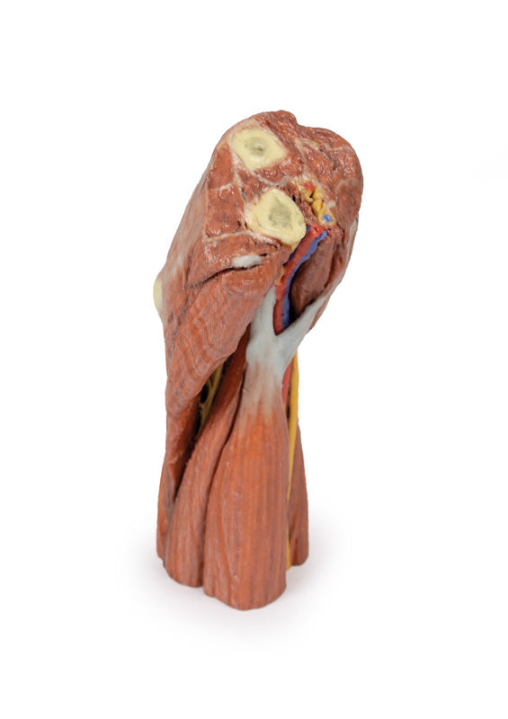 Cubital fossa - muskler, store nerver og brachialis arterie