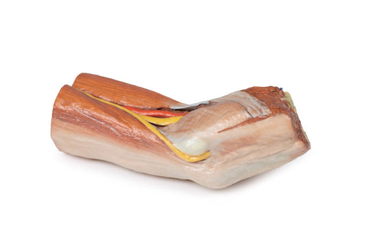 Cubital fossa - muskler, store nerver og brachialis arterie