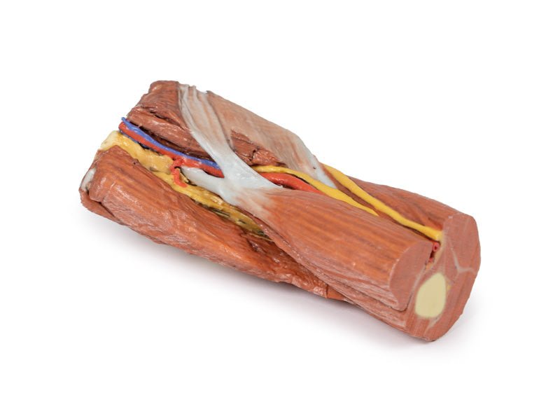 Cubital fossa - muskler, store nerver og brachialis arterie - eAnatomi