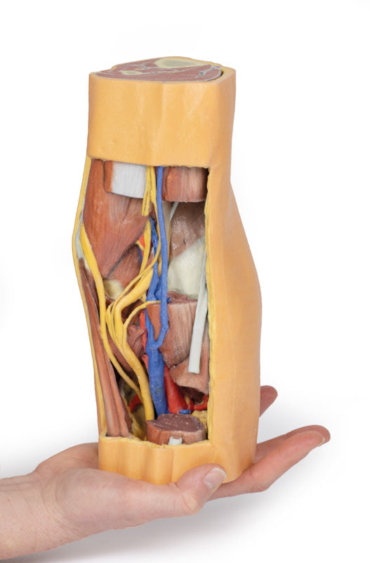 Popliteal Fossa distalt lår og proksimalt ben