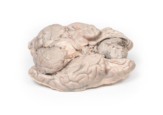 Meningiom