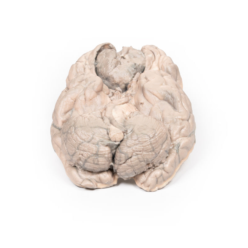 Meningiom