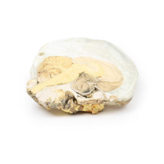 Hypofyse adenom