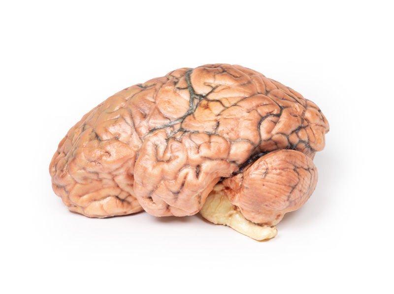 Kraniofaryngeom (Rathkes poche - tumor) - eAnatomi