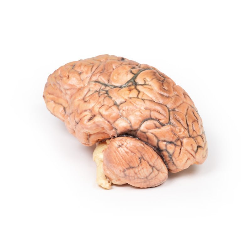 Kraniofaryngeom (Rathkes poche - tumor) - eAnatomi