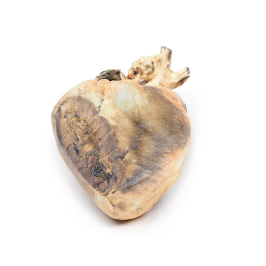 Atrial septal defekt