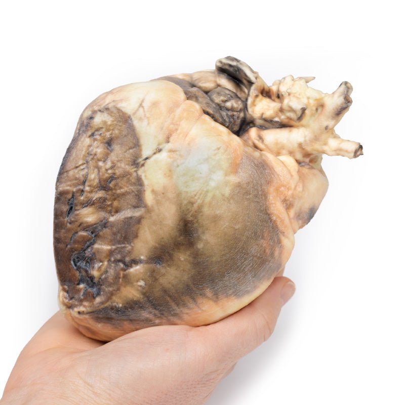 Atrial septal defekt - eAnatomi