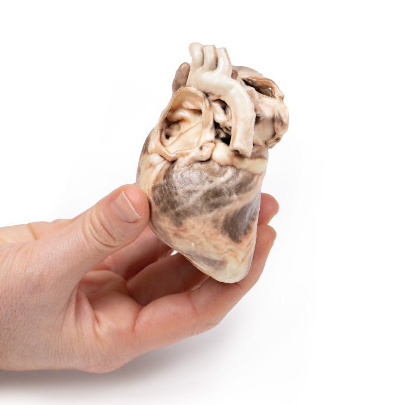 Kongenit pulmonalstenose - eAnatomi