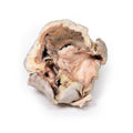 Forkalket aortastenose m. bicuspid aortaklap - eAnatomi