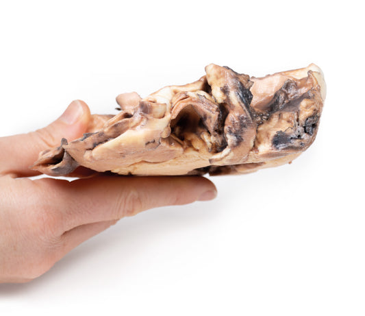 Reumatisk endocarditis