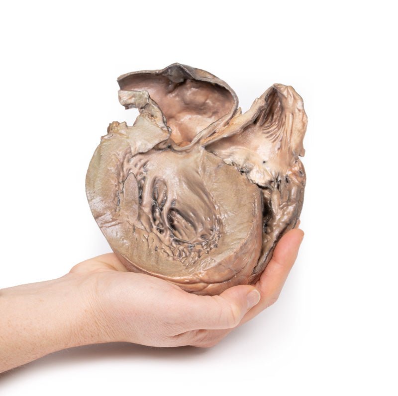Brudt thorax aortaaneurisme - eAnatomi