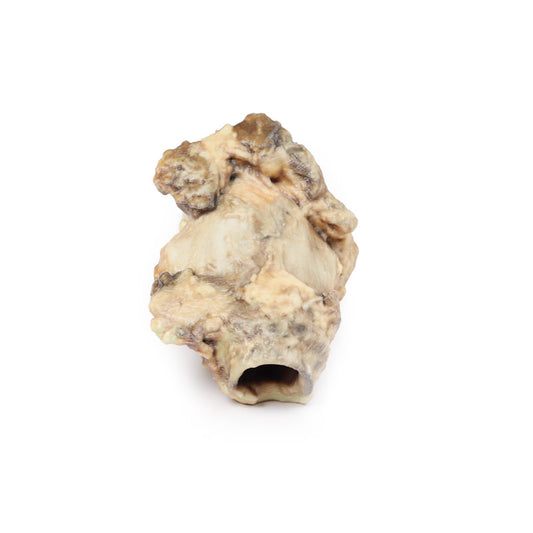 Karcinom af Pyriform Fossa