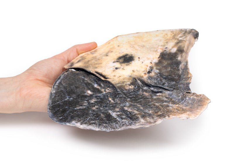 Lobær pneumoni - eAnatomi