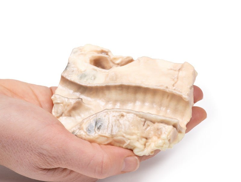 Trachea m. Hodgkins lymfom - eAnatomi