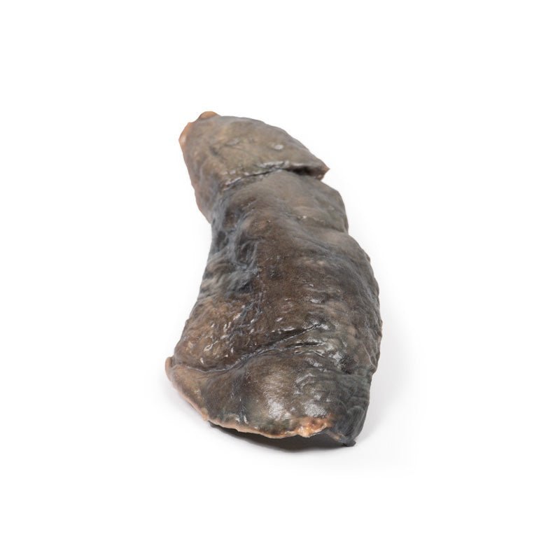 Lunge m. cystisk fibrose - eAnatomi