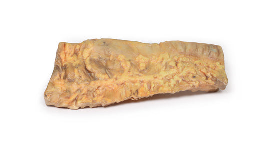 Colitis ulcerosa