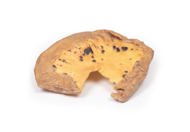 Mesenteriske metastaser fra kutan Maligna - eAnatomi