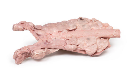 Aorta og para-aorta lymfeknuder