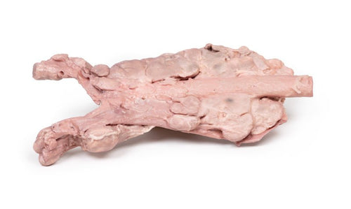 Aorta m. paraaortale lymfeknuder - eAnatomi