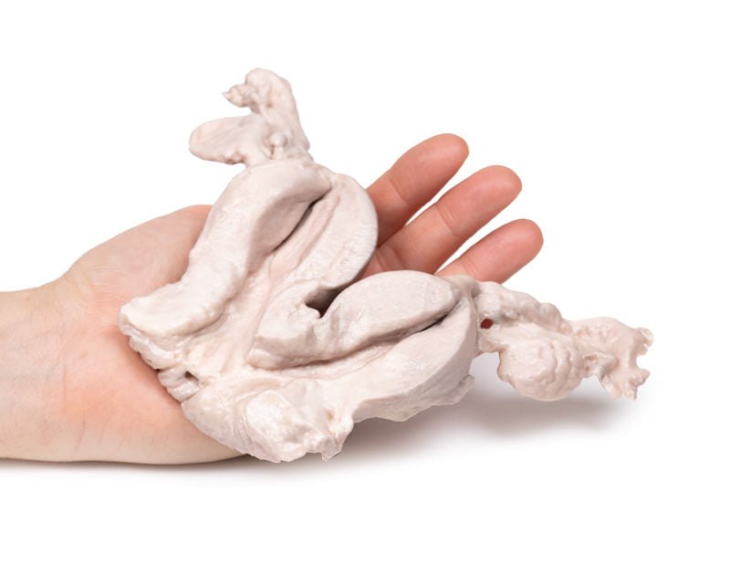 Uterus bicornis (hjerteformet livmoder) - eAnatomi