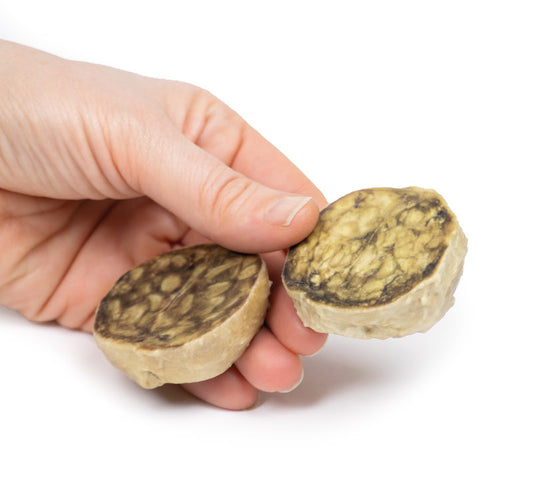 Nodulær hyperplasi af prostata