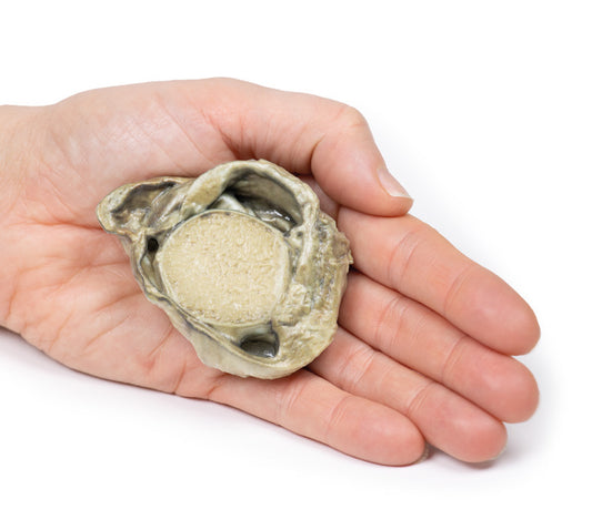 Hydrocoele