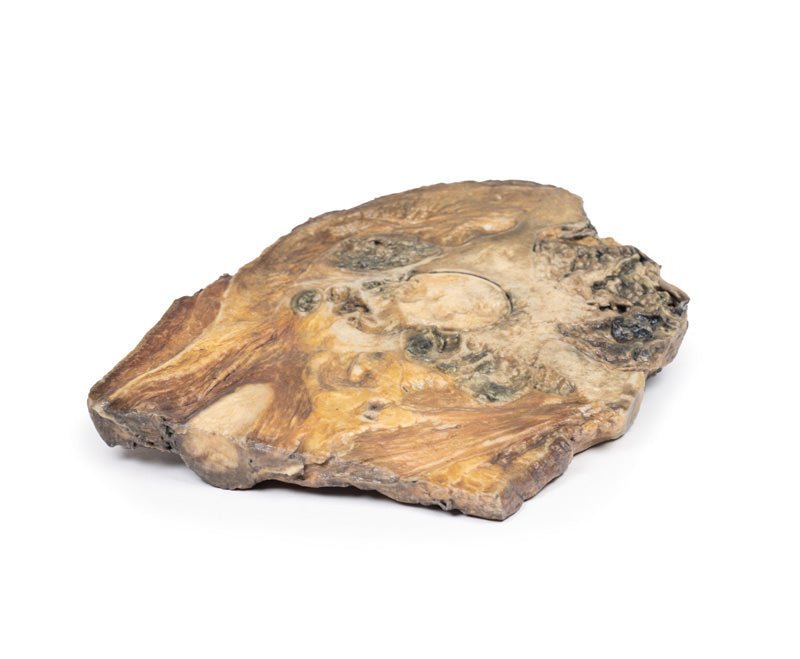 Chondrosarkom i femur og ilium - eAnatomi