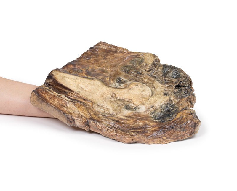 Chondrosarkom i femur og ilium - eAnatomi