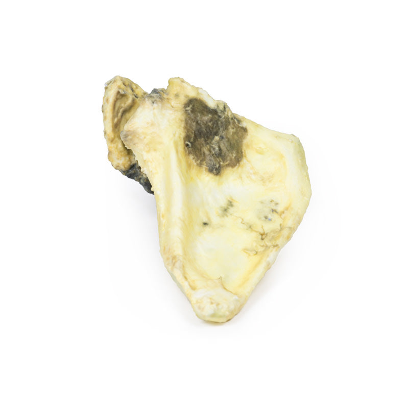 Chondrosarkom af scapula