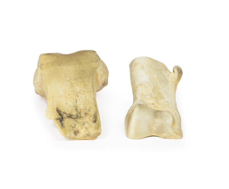 Osteochondrom