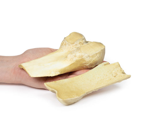 Osteochondrom