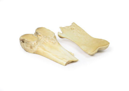 Osteochondrom