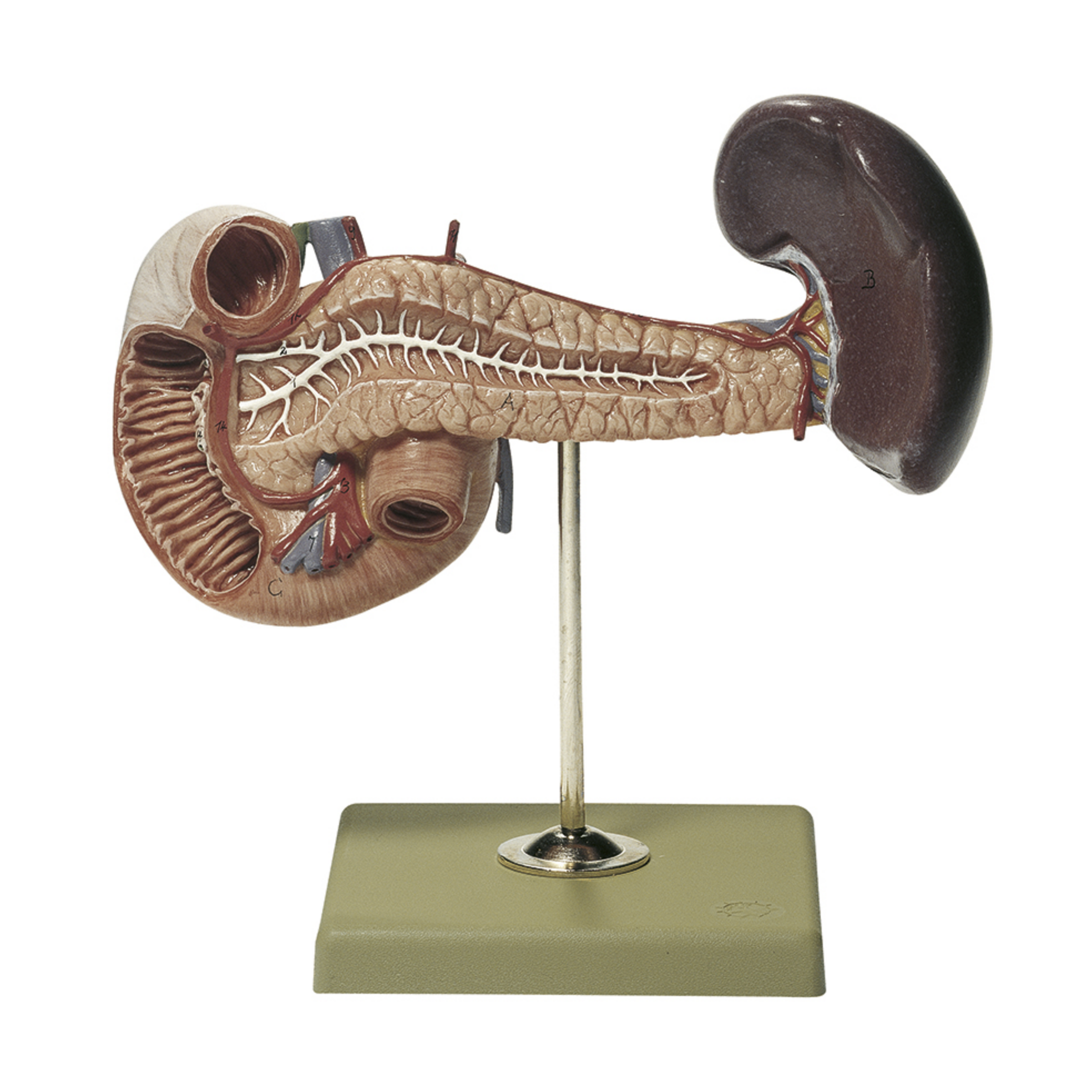 Spleen, pancreas and small intestine with overview