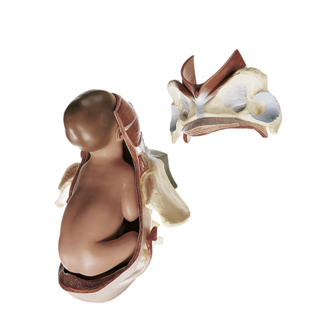 Birth in stage 2, the expulsion phase