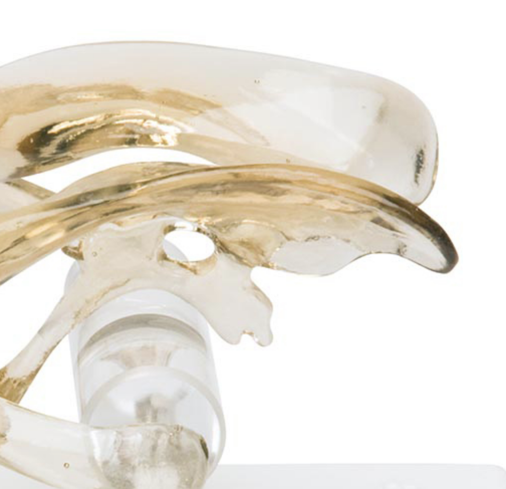 Hjärnans ventriklar