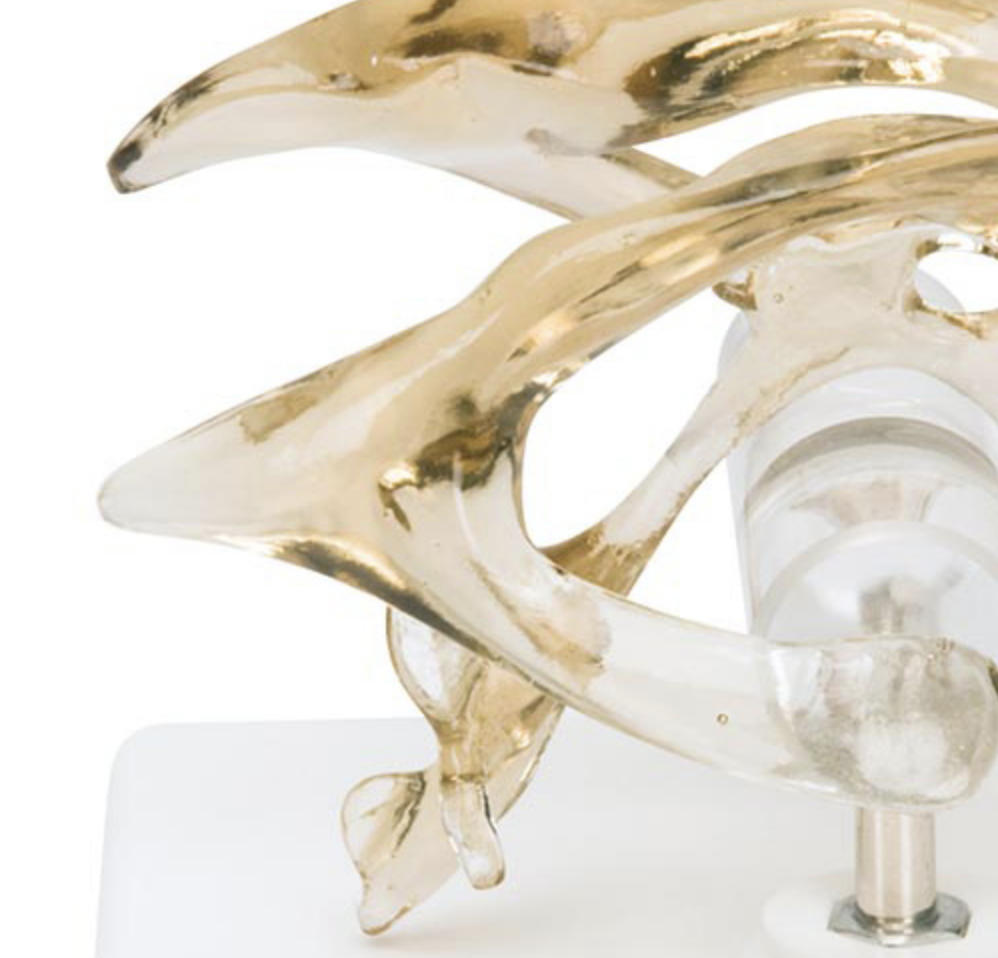 The ventricles of the brain