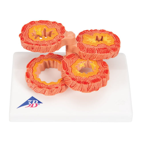 Bronkie snitflader m. KOL - eAnatomi