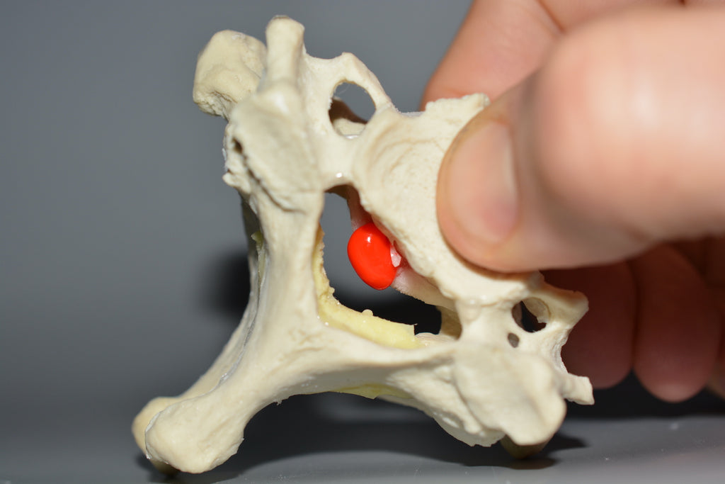 Halshvirvler m. degenerative forandringer