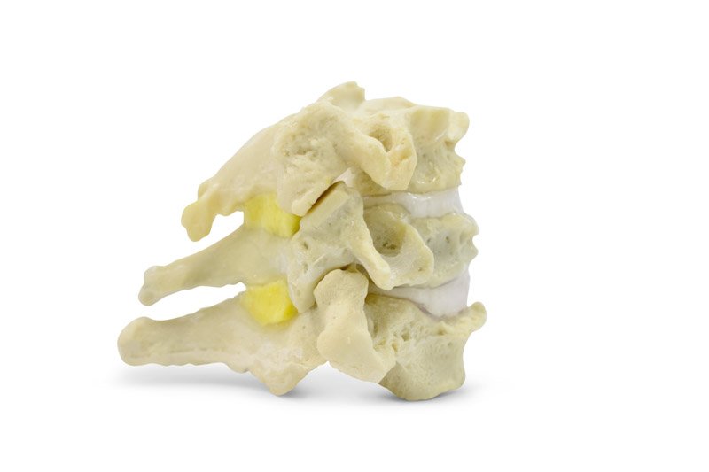 Flexible and lifelike neck vertebrae, etc. degenerative changes