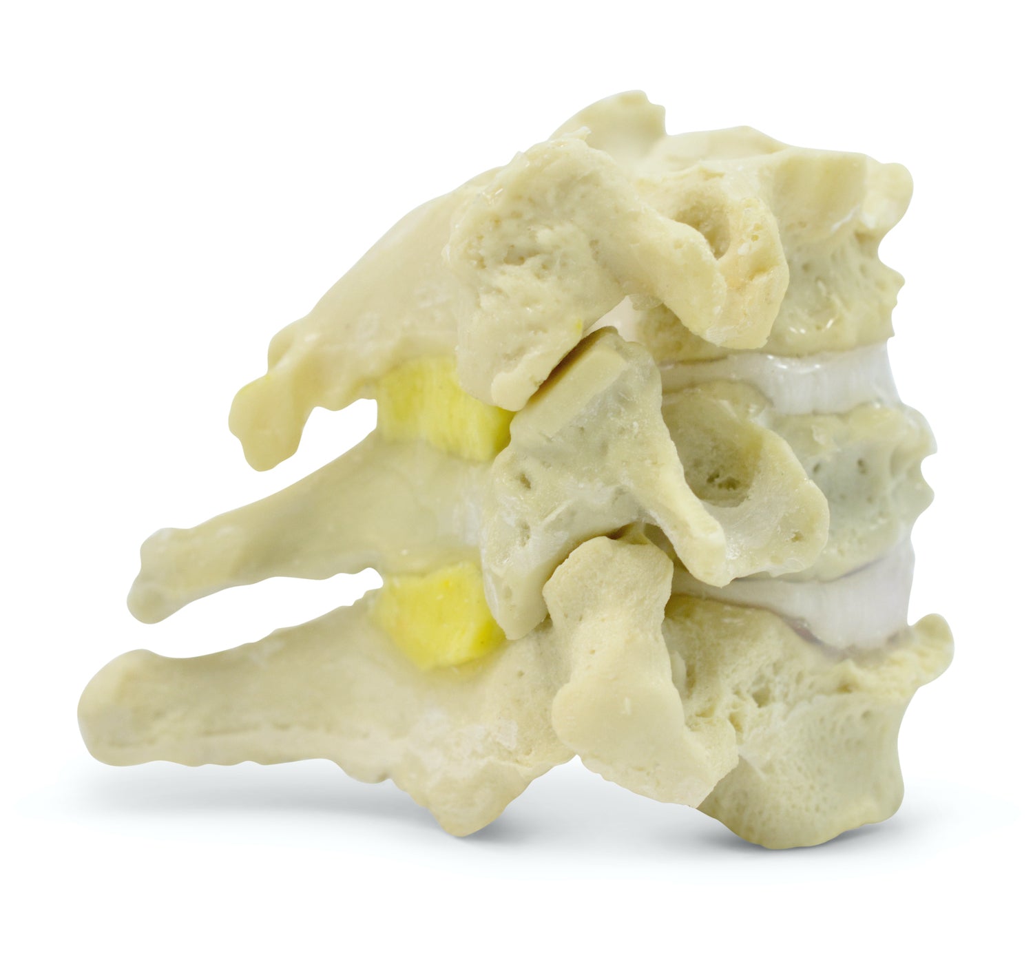 Flexible and lifelike neck vertebrae, etc. degenerative changes