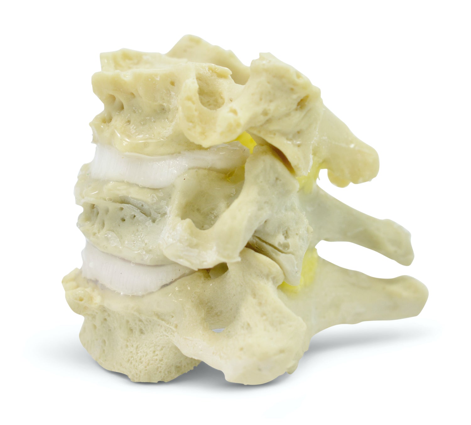 Flexible and lifelike neck vertebrae, etc. degenerative changes