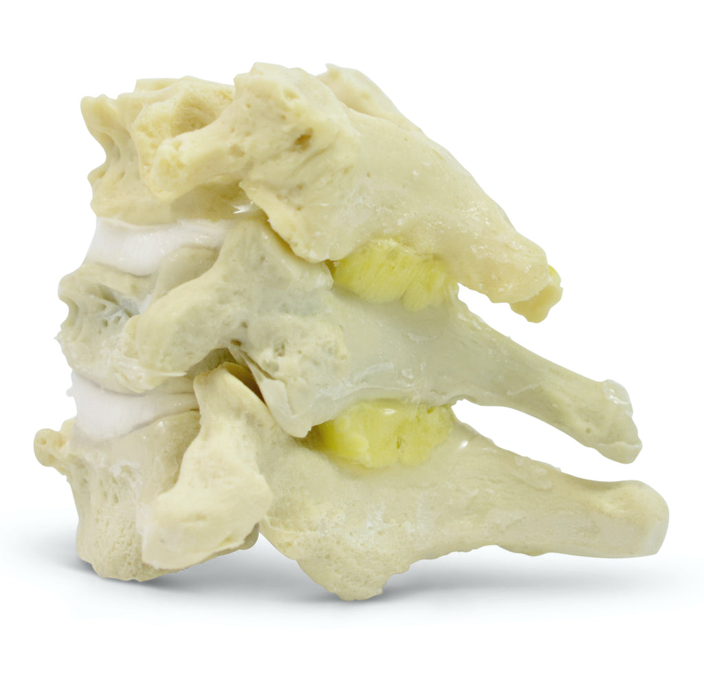 Flexibla och naturtrogna nackkotor etc. degenerativa förändringar