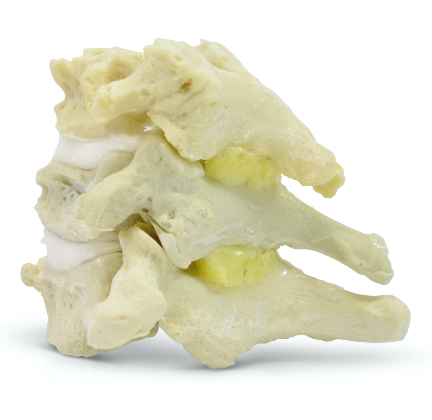 Flexible and lifelike neck vertebrae, etc. degenerative changes