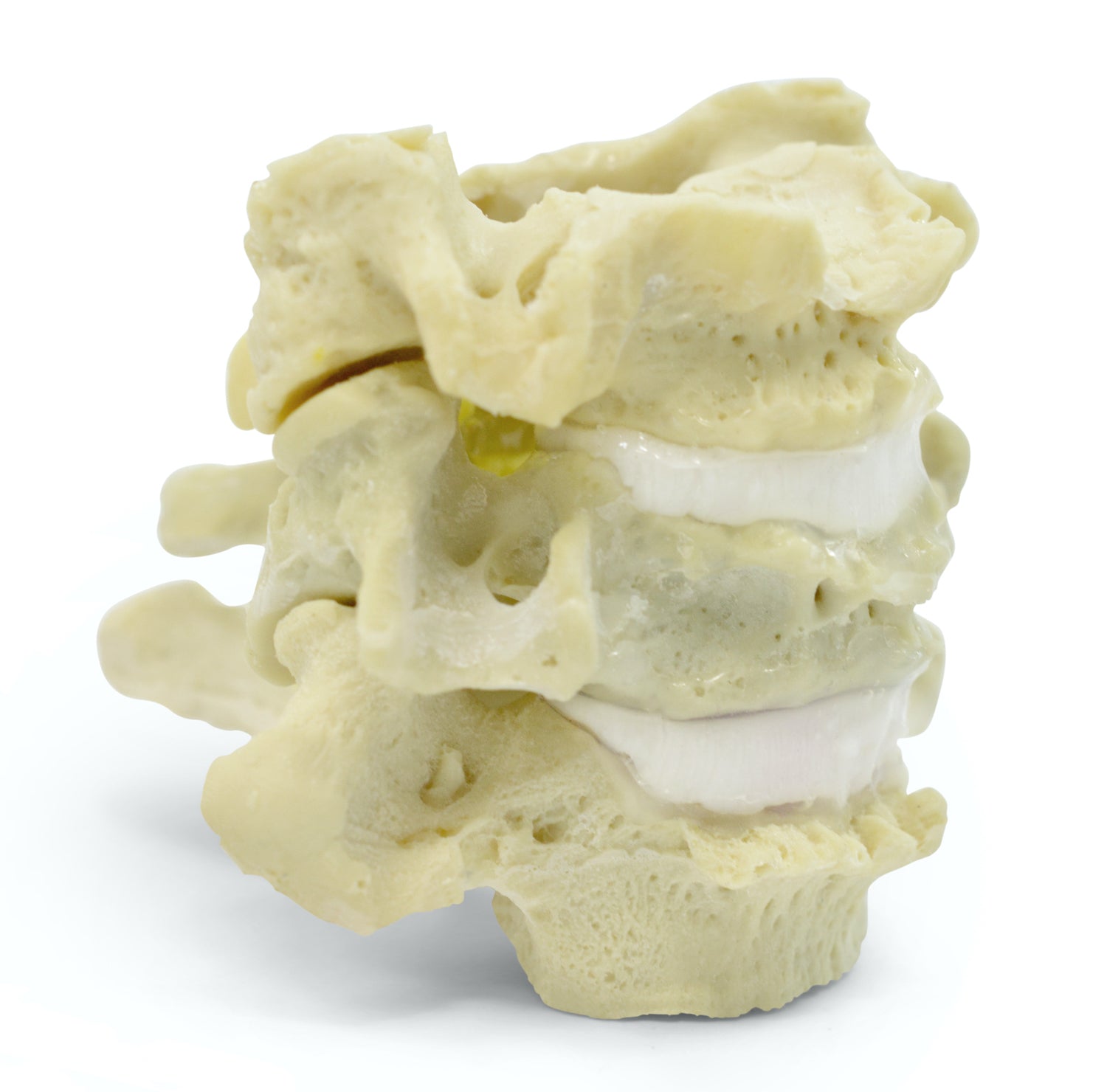 Flexible and lifelike neck vertebrae, etc. degenerative changes