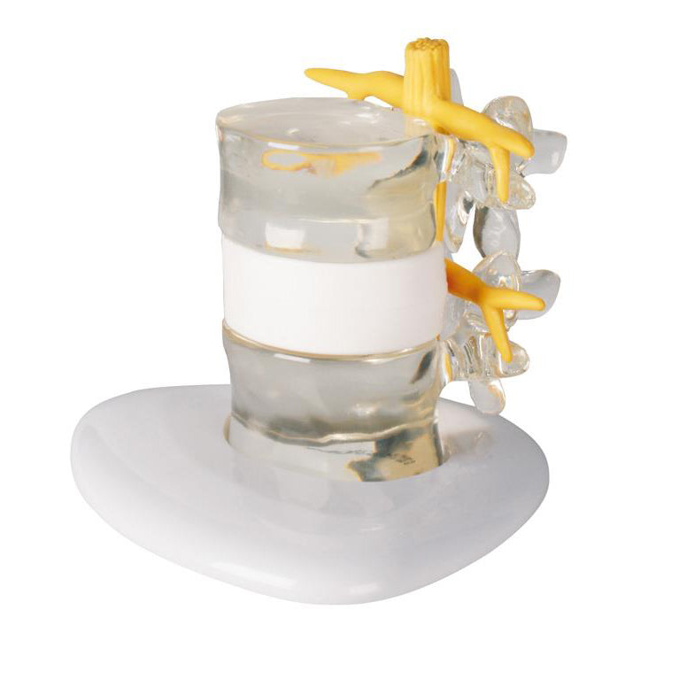 Innovativ og robust simulator af diskusprolaps